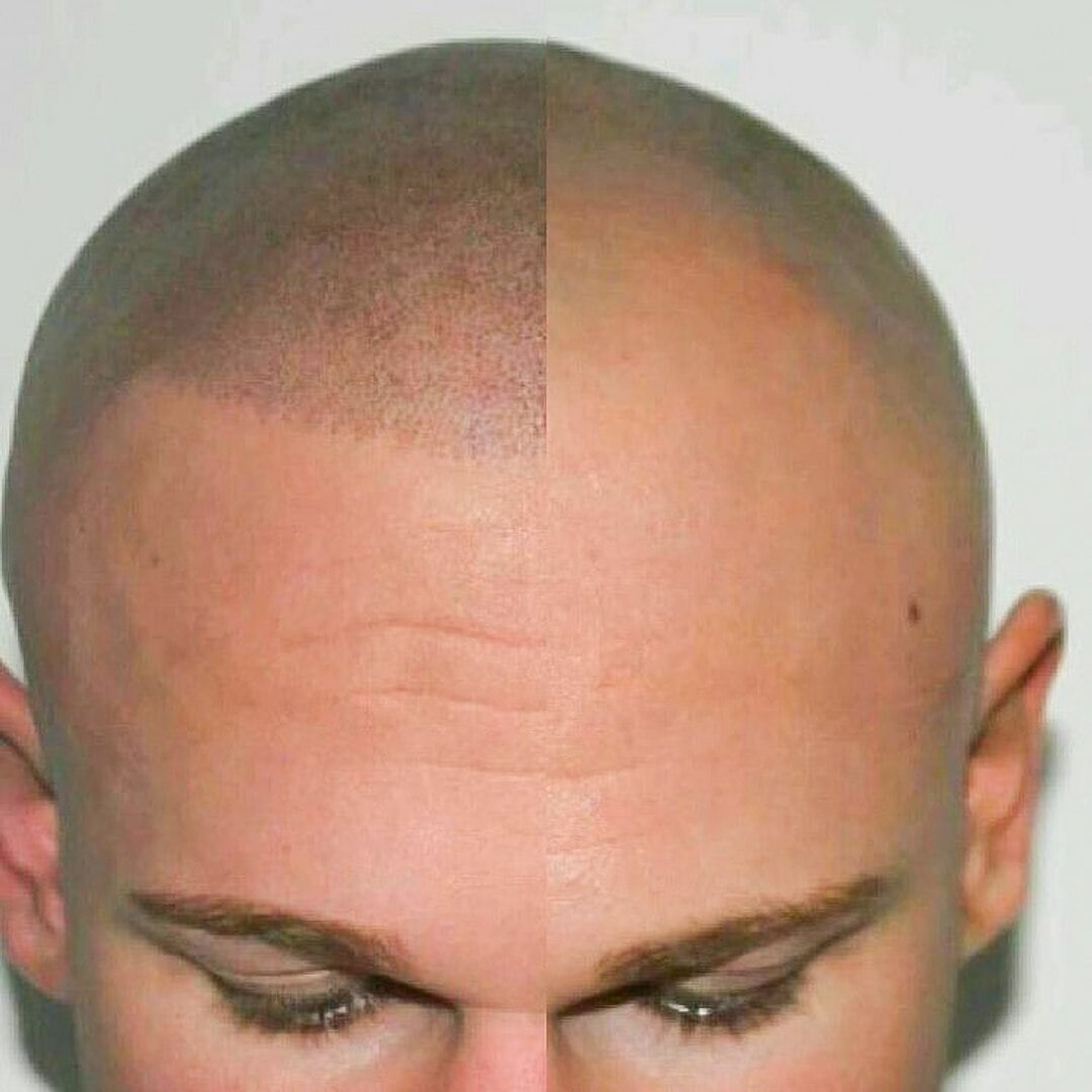 Перманентный макияж головы